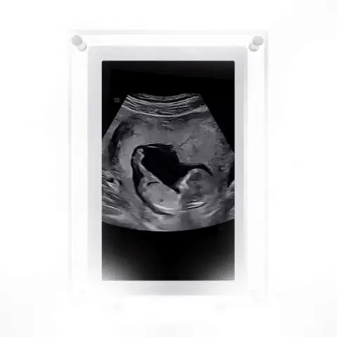 SoundSnap™ Unvergessliche Erinnerungen festhalten! KleinSelect