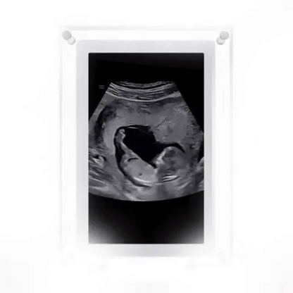 SoundSnap™ Unvergessliche Erinnerungen festhalten!