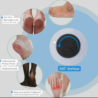 Verabschiede dich von Hornhaut – Das Geheimnis für weiche Füße